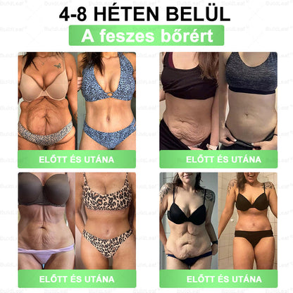 ✌𝐁𝐮𝐢𝐥𝐝𝐋𝐞𝐚𝐟® 𝐆𝐋𝐏-𝟏 𝟖-𝐢𝐧-𝟏 𝐒𝐥𝐢𝐦 & 𝐇𝐞𝐚𝐥𝐭𝐡𝐲 𝐎𝐫á𝐥𝐢𝐬 𝐌𝐞𝐠𝐨𝐥𝐝á𝐬 ✅ 𝐓á𝐦𝐨𝐠𝐚𝐭𝐣𝐚 𝐚𝐳 𝐞𝐥𝐡í𝐳á𝐬 𝐤𝐞𝐳𝐞𝐥é𝐬é𝐭, 𝐚 𝐬𝐳í𝐯- é𝐬 é𝐫𝐫𝐞𝐧𝐝𝐬𝐳𝐞𝐫𝐢 𝐞𝐠é𝐬𝐳𝐬é𝐠𝐞𝐭, 𝐚 𝐜𝐮𝐤𝐨𝐫𝐛𝐞𝐭𝐞𝐠𝐬é𝐠𝐞𝐭, 𝐚𝐳 𝐚𝐥𝐯á𝐬𝐢 𝐚𝐩𝐧𝐨é𝐭, 𝐚 𝐛é𝐥𝐫𝐞𝐧𝐝𝐬𝐳𝐞𝐫 𝐞𝐠é𝐬𝐳𝐬é𝐠é𝐭, 𝐦𝐢𝐤ö𝐳𝐛𝐞𝐧 𝐟𝐞𝐬𝐳𝐞𝐬í𝐭𝐢 𝐚 𝐛ő𝐫𝐭 é𝐬 𝐧ö𝐯𝐞𝐥𝐢 𝐚𝐳 𝐞𝐧𝐞𝐫𝐠𝐢á𝐭.