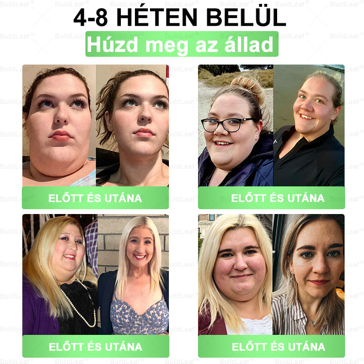 ✌𝐁𝐮𝐢𝐥𝐝𝐋𝐞𝐚𝐟® 𝐆𝐋𝐏-𝟏 𝟖-𝐢𝐧-𝟏 𝐒𝐥𝐢𝐦 & 𝐇𝐞𝐚𝐥𝐭𝐡𝐲 𝐎𝐫á𝐥𝐢𝐬 𝐌𝐞𝐠𝐨𝐥𝐝á𝐬 ✅ 𝐓á𝐦𝐨𝐠𝐚𝐭𝐣𝐚 𝐚𝐳 𝐞𝐥𝐡í𝐳á𝐬 𝐤𝐞𝐳𝐞𝐥é𝐬é𝐭, 𝐚 𝐬𝐳í𝐯- é𝐬 é𝐫𝐫𝐞𝐧𝐝𝐬𝐳𝐞𝐫𝐢 𝐞𝐠é𝐬𝐳𝐬é𝐠𝐞𝐭, 𝐚 𝐜𝐮𝐤𝐨𝐫𝐛𝐞𝐭𝐞𝐠𝐬é𝐠𝐞𝐭, 𝐚𝐳 𝐚𝐥𝐯á𝐬𝐢 𝐚𝐩𝐧𝐨é𝐭, 𝐚 𝐛é𝐥𝐫𝐞𝐧𝐝𝐬𝐳𝐞𝐫 𝐞𝐠é𝐬𝐳𝐬é𝐠é𝐭, 𝐦𝐢𝐤ö𝐳𝐛𝐞𝐧 𝐟𝐞𝐬𝐳𝐞𝐬í𝐭𝐢 𝐚 𝐛ő𝐫𝐭 é𝐬 𝐧ö𝐯𝐞𝐥𝐢 𝐚𝐳 𝐞𝐧𝐞𝐫𝐠𝐢á𝐭.